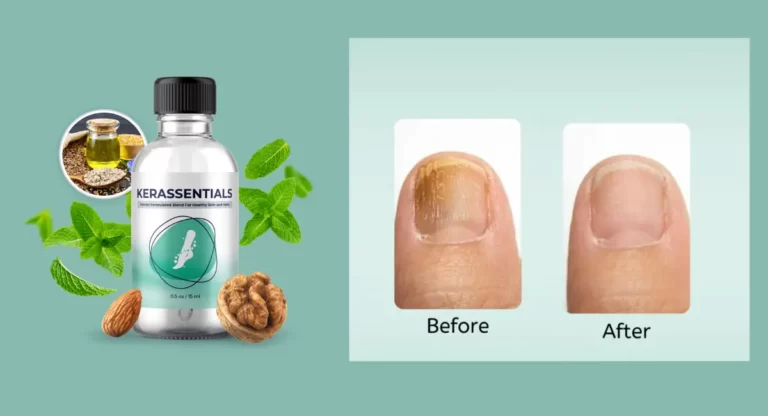 Kerassentials for Toenail Fungus Reviews