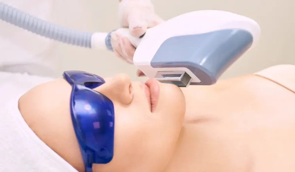 Laser Hair Removal Permanent